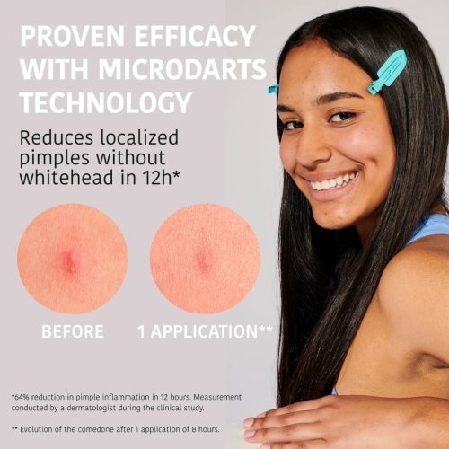 Iroha Nature hidrokoloidiniai pleistrai nuo spuogų su mikroadatėlėmis Microdarts Pimple Patches With Salicylic Acid, 12vnt.